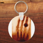 The First X ray, 1901, Photograph キーホルダー (正面)