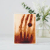 The First X ray, 1901, Photograph ポストカード (スタンド正面)
