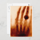The First X ray, 1901, Photograph ポストカード (正面/裏面)