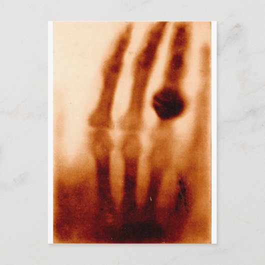The First X ray, 1901, Photograph ポストカード (正面)