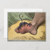 The Gout (18世紀の漫画家ジェームス・ギレイによる) ポストカード (正面/裏面)