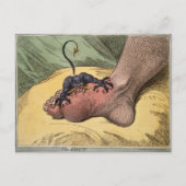 The Gout （18世紀の漫画家ジェームス・ギレイによる） ポストカード (正面)