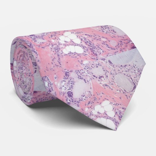 Tophaceous痛風の病理学 ネクタイ (ロール)