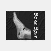 Trump Bone Spur Ink Pen Funny Anti Trump  フリースブランケット (正面(横))