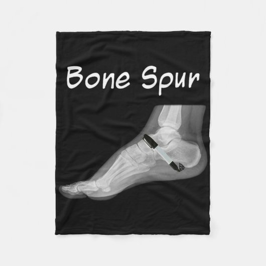 Trump Bone Spur Ink Pen Funny Anti Trump  フリースブランケット (正面)