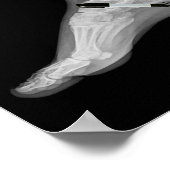 Trump Bone Spur Ink Pen Funny Anti Trump  ポスター (角)