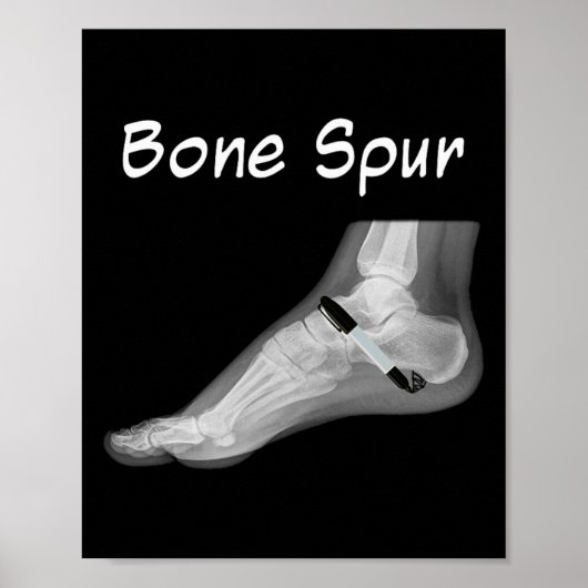 Trump Bone Spur Ink Pen Funny Anti Trump  ポスター (正面)