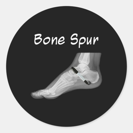 Trump Bone Spur Ink Pen Funny Anti Trump  ラウンドシール (正面)