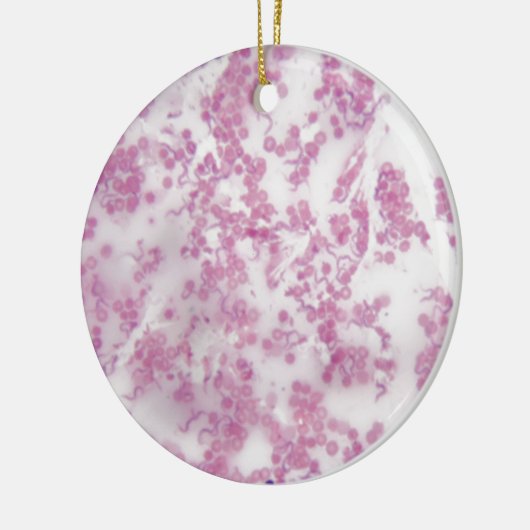 Trypanosoma bの人の血液の顕微鏡の写真 セラミックオーナメント (左)