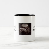 Ultrasound Photo Christian祈を持っている ツートーンマグカップ (中央)