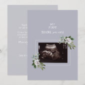 Ultrasound Photo Girl Thank YouベビーPoint of View サンキューカード (正面/裏面)