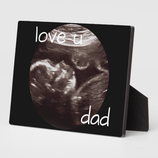 Ultrasound Photo Love Youパパ フォトプラーク (側面)