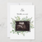 Ultrasound Photo Neutral Thank Youベビー サンキューカード (正面)