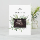 Ultrasound Photo Neutral Thank Youベビー サンキューカード (スタンド正面)