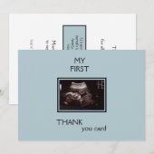 Ultrasound Photo Thank Thank You From Technology P サンキューカード (正面/裏面)