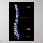 Vertebral Column 3 ポスター (正面)