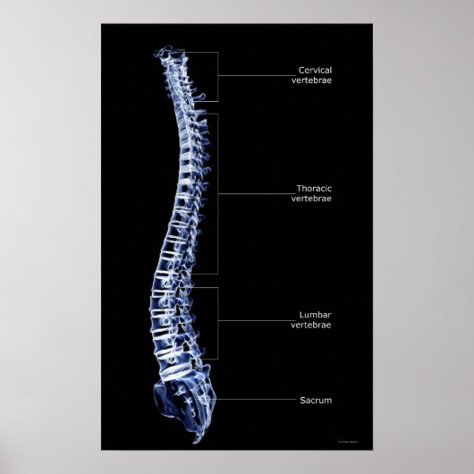 Vertebral Column 3 ポスター (正面)