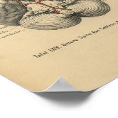 Vintage 1888 German Anatomy Print Brain ポスター (角)