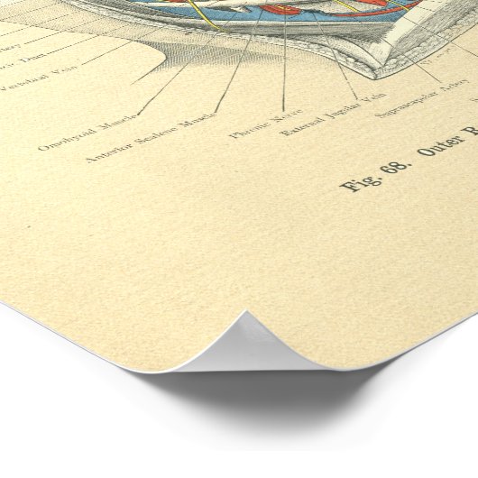 Vintage Frohse Anatomical Lateral Neck ポスター (角)