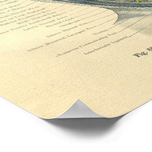 Vintage Frohse Anatomical Lateral Neck ポスター (角)