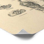 Vintage Larynx Anatomy 1880 Print ポスター (角)