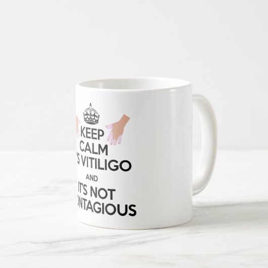 Vitiligoの認識度の毎日のマグ! コーヒーマグカップ (正面右)