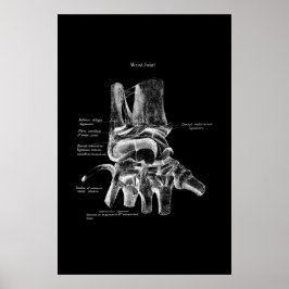 Wrist Anatomy Medical Poster Orthopedic Decor ポスター