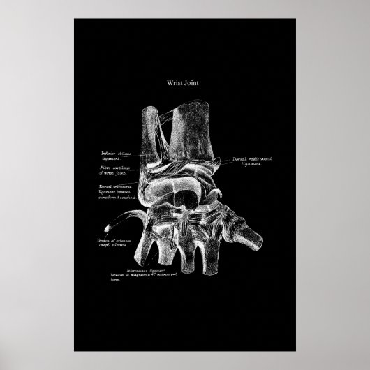 Wrist Anatomy Medical Poster Orthopedic Decor ポスター (正面)