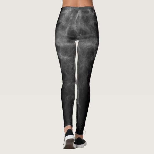 X光線の放射線学の医学の解剖学の骨組レギング レギンス (裏面)