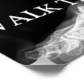 X線に向かって歩く ポスター (角)