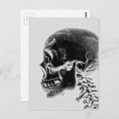 X線のスカル ポストカード (正面/裏面)