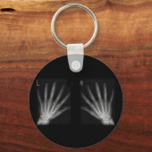 X線の右指と手離れ指数 キーホルダー (正面)