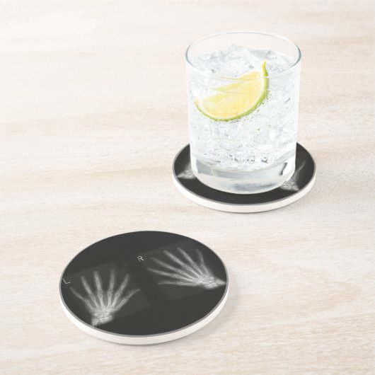 X線の右指と手離れ指数 コースター (側面)