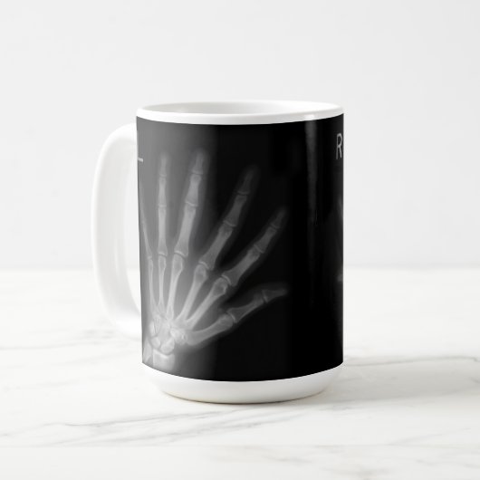 X線の右指と手離れ指数 コーヒーマグカップ (正面左)
