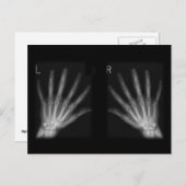 X線の右指と手離れ指数 ポストカード (正面/裏面)