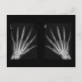 X線の右指と手離れ指数 ポストカード (正面)