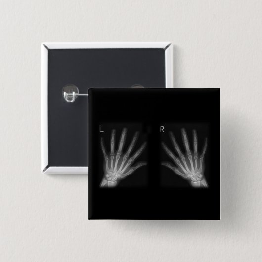 X線の右指と手離れ指数 缶バッジ (正面&裏面)