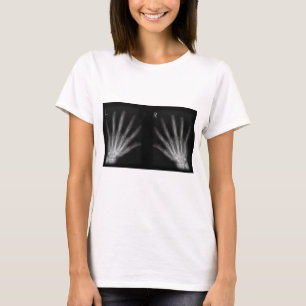 X線の右指と手離れ指数 Tシャツ