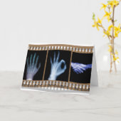 X線の手話のフィルム-手の良い握手 カード (黄色い花)