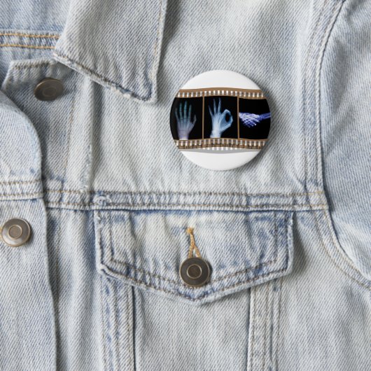 X線の手話のフィルム-手の良い握手 缶バッジ (インサイチュ)