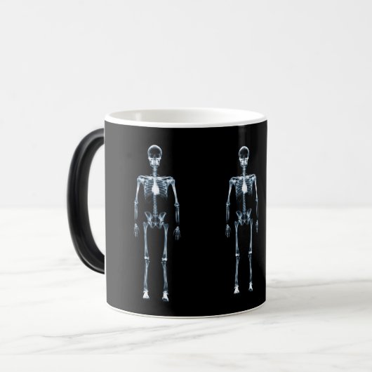 X線の視野の青の独身のな骨組 モーフィングマグカップ (正面左)