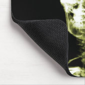 X線の視野の骨組スカル-黄色 マウスパッド (コーナー)