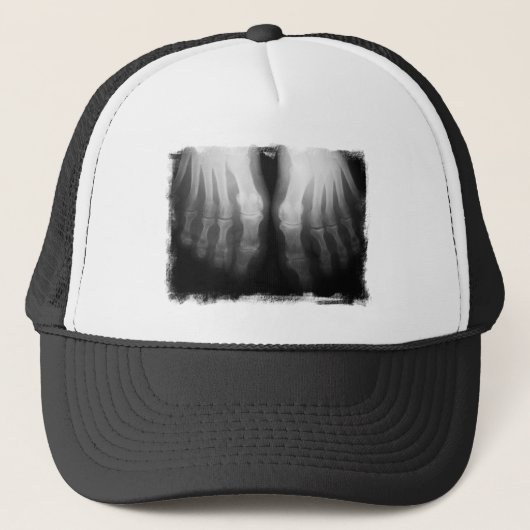 X線の足の人間の骨組骨炭及び白 キャップ (正面)