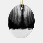 X線の足の人間の骨組骨炭及び白 セラミックオーナメント (右)