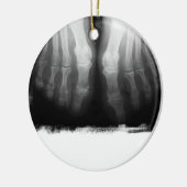 X線の足の人間の骨組骨炭及び白 セラミックオーナメント (左)