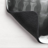 X線の足の人間の骨組骨炭及び白 マウスパッド (コーナー)