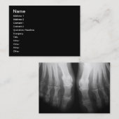 X線の足の人間の骨組骨炭及び白 名刺 (正面/裏面)