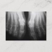 X線の足の人間の骨組骨炭及び白 名刺 (裏面)