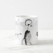 X線の骨組午後の散歩のNeg BW コーヒーマグカップ (中央)