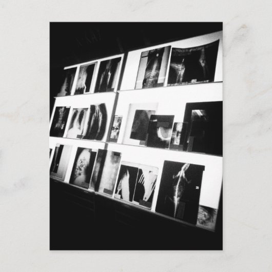 X線はがき ポストカード (正面)
